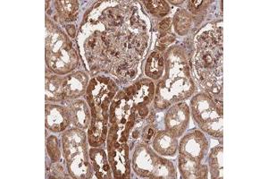 Immunohistochemical staining of human kidney with SAC3D1 polyclonal antibody  shows strong cytoplasmic positivity in cells in tubules at 1:200-1:500 dilution. (SAC3D1 antibody)