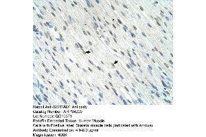 Human Muscle (SERTAD1 antibody  (N-Term))