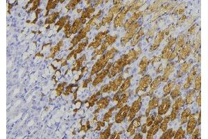 ABIN6278469 at 1/100 staining Human gastric tissue by IHC-P. (GUCY1B2 antibody)