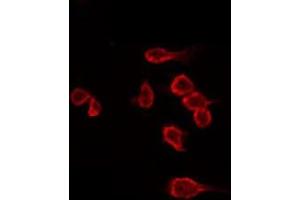 ABIN6266530 staining Hela by IF/ICC. (Dysferlin antibody  (C-Term))