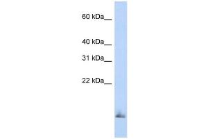 WB Suggested Anti-SCGB1A1 Antibody Titration:  0. (SCGB1A1 antibody  (Middle Region))