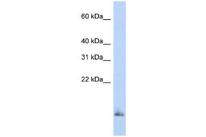 WB Suggested Anti-SCGB1A1 Antibody Titration:  0. (SCGB1A1 antibody  (Middle Region))