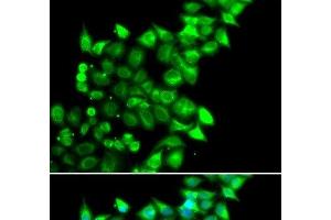 Immunofluorescence analysis of U2OS cells using MEST Polyclonal Antibody (MEST antibody)
