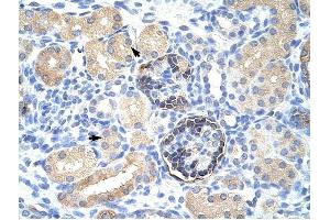 CLIC5 antibody was used for immunohistochemistry at a concentration of 4-8 ug/ml to stain Epithelial cells of renal tubule (arrows) in Human Kidney. (CLIC5 antibody  (C-Term))