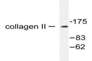Image no. 2 for anti-Collagen, Type II, alpha 1 (COL2A1) (Chain alpha 1) antibody (ABIN265366)