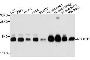 Western blot analysis of extracts of mouse liver tissue lines, using NDUFS5 antibody. (NDUFS5 antibody)