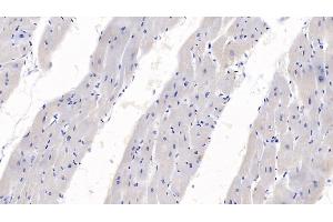Detection of SEMA3A in Human Heart Tissue using Monoclonal Antibody to Semaphorin 3A (SEMA3A) (SEMA3A antibody  (AA 580-664))