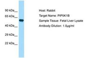 Image no. 1 for anti-Phosphatidylinositol-4-Phosphate 5-Kinase, Type I, beta (PIP5K1B) (AA 395-444) antibody (ABIN6750033) (PIP5K1B antibody  (AA 395-444))