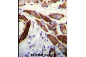 FLNA Antibody (Y1046) immunohistochemistry analysis in formalin fixed and paraffin embedded human skeletal muscle followed by peroxidase conjugation of the secondary antibody and DAB staining. (Filamin A antibody  (AA 1025-1054))