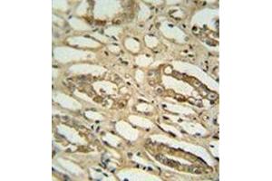 Immunohistochemistry analysis in formalin fixed and paraffin embedded human lung tissue reacted with GGTLC2 Antibody (Center) followed peroxidase conjugated to the secondary antibody and followed by DAB staining. (GGTLC2 antibody  (Middle Region))