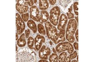 Immunohistochemical staining of human kidney with CPSF3L polyclonal antibody  shows strong cytoplasmic positivity in cells in tubules. (CPSF3L antibody)