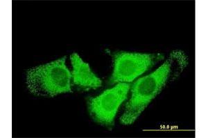 Immunofluorescence of monoclonal antibody to SCYE1 on HeLa cell. (AIMP1 antibody  (AA 1-312))