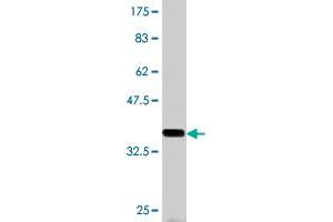 Western Blot detection against Immunogen (36. (NBR1 antibody  (AA 2-96))