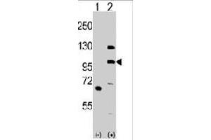 Western blot analysis of MLK4 (arrow) using rabbit MLK4 polyclonal antibody . (MLK4 antibody  (N-Term))