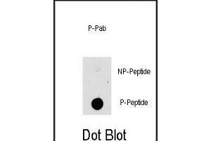 Dot blot analysis of anti-K1-p Phospho-specific b (ABIN389799 and ABIN2839695) on nitrocellulose membrane. (MAP3K8 antibody  (pThr290))