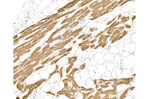 Immunohistochemistry (IHC) image for anti-Myosin, Light Chain 1, Alkali, Skeletal, Fast (MYL1) (Light Chain) antibody (ABIN7795615)