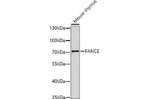 Western blot analysis of extracts of mouse thymus, using FANCE antibody (ABIN6129378, ABIN6140472, ABIN6140473 and ABIN6224472) at 1:1000 dilution. (FANCE antibody  (AA 1-255))