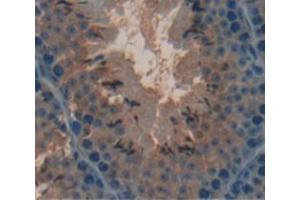 Figure. (COMP antibody  (AA 40-180))