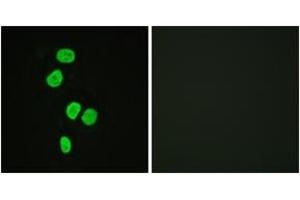 Immunofluorescence analysis of HeLa cells, using AS160 (Ab-642) Antibody. (TBC1D4 antibody  (AA 611-660))