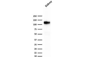 Western Blotting (WB) image for anti-Cadherin-16 (CDH16) antibody (ABIN6939021)