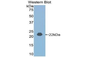 Western blot analysis of the recombinant protein. (IFNA4 antibody  (AA 33-189))