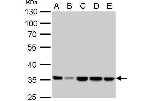 WB Image LDHA antibody detects LDHA protein by Western blot analysis. (Lactate Dehydrogenase A antibody)
