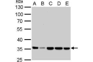 WB Image LDHA antibody detects LDHA protein by Western blot analysis.