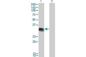 Western Blot analysis of SCML1 expression in transfected 293T cell line by SCML1 monoclonal antibody (M01), clone 4G3. (SCML1 antibody  (AA 3-100))