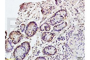 Formalin-fixed and paraffin embedded rat colitis tissue labeled with Anti CD98 Polyclonal Antibody, Unconjugated (ABIN719546) at 1:200 followed by conjugation to the secondary antibody and DAB staining (SLC3A2 antibody  (AA 231-280))