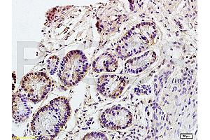 Formalin-fixed and paraffin embedded rat colitis tissue labeled with Anti CD98 Polyclonal Antibody, Unconjugated (ABIN719546) at 1:200 followed by conjugation to the secondary antibody and DAB staining (SLC3A2 antibody  (AA 231-280))