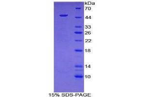 SDS-PAGE analysis of Mouse HYAL1 Protein. (HYAL1 Protein)