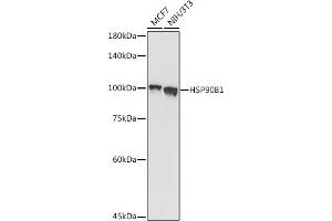 Western blot analysis of extracts of various cell lines, using HSP90B1 antibody (ABIN6130434, ABIN6142031, ABIN6142033 and ABIN7101795) at 1:1000 dilution. (GRP94 antibody  (AA 550-650))