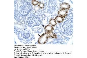 Human kidney (EIF2AK2 antibody  (C-Term))