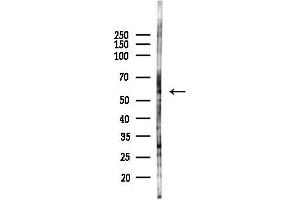 anti-Solute Carrier Family 16, Member 12 (Monocarboxylic Acid Transporter 12) (SLC16A12) (C-Term) antibody