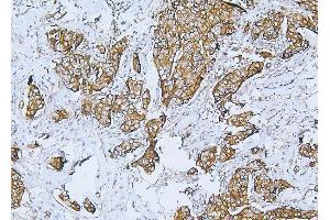 IHC analysis of Filamin B/FLNB using anti-Filamin B/FLNB antibody (ABIN7601607). (FLNB antibody  (AA 397-701))