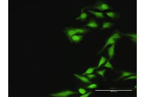 Immunofluorescence of purified MaxPab antibody to ASPSCR1 on HeLa cell. (ASPSCR1 antibody  (AA 1-553))