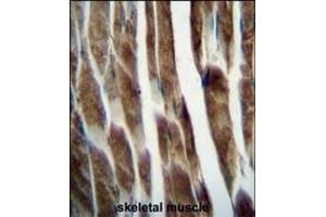 ILK Antibody (Center) 5884c immunohistochemistry analysis in formalin fixed and paraffin embedded human skeletal muscle followed by peroxidase conjugation of the secondary antibody and DAB staining. (ILKAP antibody  (AA 243-270))