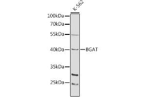 Western blot analysis of extracts of K-562 cells, using BGAT antibody (ABIN3022190, ABIN3022191, ABIN3022192 and ABIN6218658) at 1:1000 dilution. (ABO antibody  (AA 54-354))