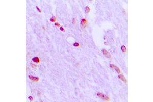 Immunohistochemical analysis of AIFM1 staining in human brain formalin fixed paraffin embedded tissue section. (AIF antibody  (N-Term))