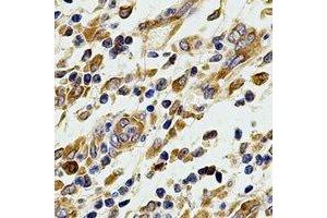 Immunohistochemical analysis of COX2 staining in human stomach formalin fixed paraffin embedded tissue section. (COX2 antibody)