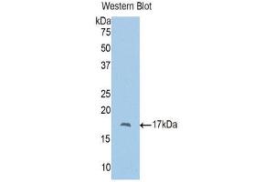 Western Blotting (WB) image for anti-Polybromo 1 (PBRM1) (AA 957-1086) antibody (ABIN1860136) (Polybromo 1 antibody  (AA 957-1086))