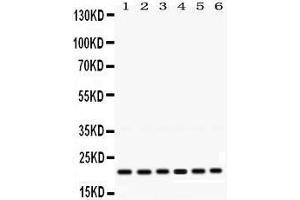 Western Blotting (WB) image for anti-RAB10, Member RAS Oncogene Family (RAB10) (AA 153-185), (C-Term) antibody (ABIN3043448) (RAB10 antibody  (C-Term))