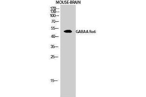 Western Blotting (WB) image for anti-gamma-aminobutyric Acid (GABA) A Receptor, alpha 6 (GABRA6) (Internal Region) antibody (ABIN3175195) (GABRA6 antibody  (Internal Region))