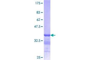 Lamin B1 Protein (LMNB1) (AA 107-186) (GST tag)