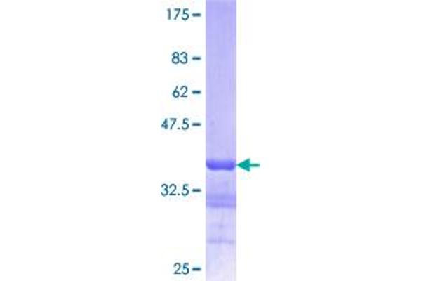 Lamin B1 Protein (LMNB1) (AA 107-186) (GST tag)