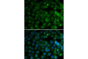 Immunofluorescence analysis of U2OS cells using HPD antibody. (HPD antibody  (AA 1-393))