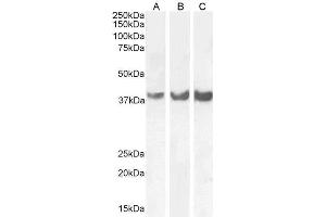 ABIN6391407 (0. (Homeobox D13 antibody  (Internal Region))