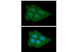 ICC/IF analysis of PGD in Hep3B cells line, stained with DAPI (Blue) for nucleus staining and monoclonal anti-human PGD antibody (1:100) with goat anti-mouse IgG-Alexa fluor 488 conjugate (Green).