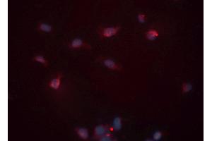 ABIN6276530 staining HeLa cells by ICC/IF. (Cardiac Troponin T2 antibody  (C-Term))