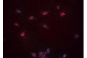 ABIN6276530 staining HeLa cells by ICC/IF. (Cardiac Troponin T2 antibody  (C-Term))